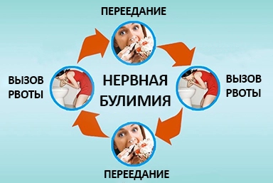 Лечение булимии в Кизилюрте